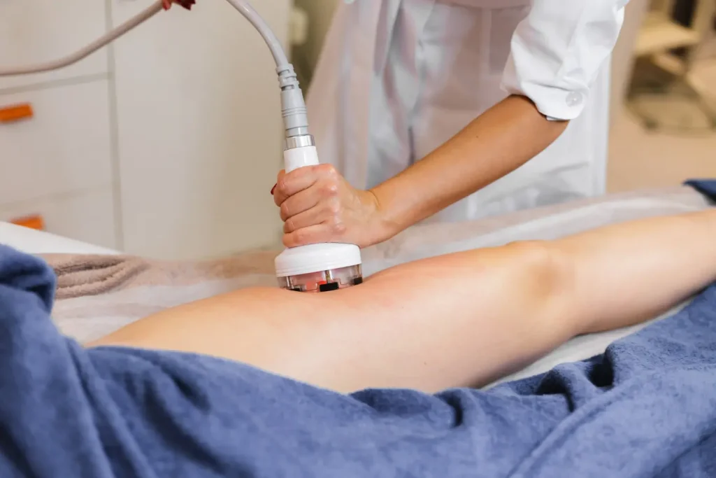 esteticista tratando celulite na coxa de cliente, por meio de criofrequência em clínica de estética