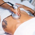 Mulher usando ultrassom em estética para tratar gordura localizada no abdômen de sua cliente